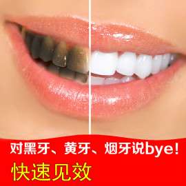 30分钟速效美白牙齿美白神器美牙凝胶牙齿美白仪套装