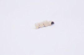 金属烤瓷牙 金钯烤瓷牙