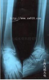 F50-100II床边x光机 移动式x射线机