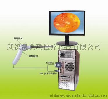 肛肠科USB接口检查系统-----肛门镜、直肠镜、结肠镜