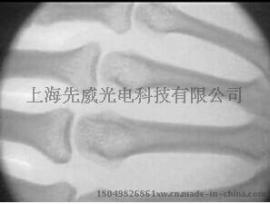 医用便携式x光机透视仪75mm