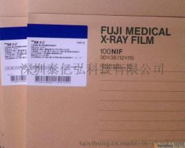 富士感蓝医用干式胶片 14*17 正品行货 质量保证 诚信商家