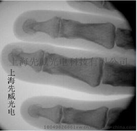医用便携式x光机透视仪