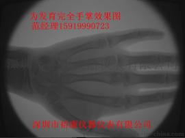 骨龄骨密度检测医用X光机骨龄机专业为运动员检测骨龄订制