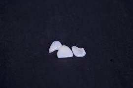 美白贴面 深圳直销 德国进口超薄贴面 义获嘉全瓷
